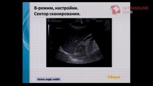 Эксклюзивное видео: Основные режимы визуализации и принципы настройки УЗ-сканера