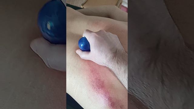 Баночный вакуумный массаж отрывок практики