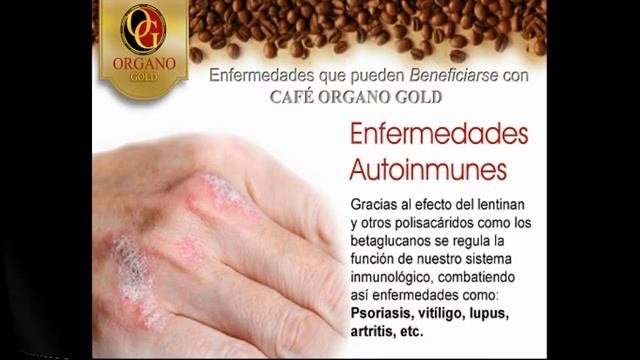 Beneficios del Ganoderma Lucidum (Reishi) смотреть онлайн