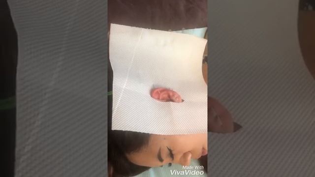 Быстрый и безболезненный тройной прокол уха?. Мочка,мочка,хрящ?