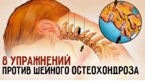 8 потрясающих Упражнений от Шейного Остеохондроза! Сделай шаг к здоровью!