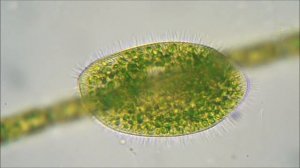 Инфузория Бурсария (Ciliate Paramecium bursaria)