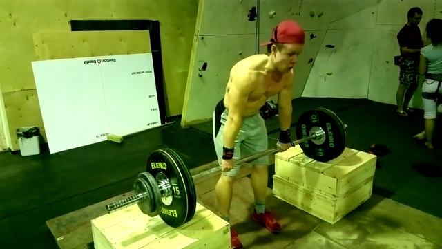 Восстановление подвижности кисти после гипса смотреть онлайн