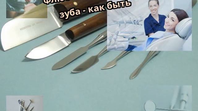 Флюс после удаления зуба - как быть смотреть онлайн