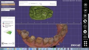 Сопоставление сканов по прикусному шаблону