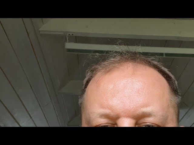 Как перестать болеть простудой в постковидные времена!