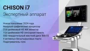 Chison i7 внешний вид