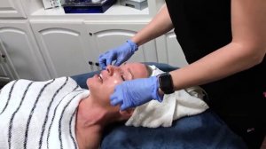 Stimulator Peel AKA The Wedding Peel with Amanda Peterson