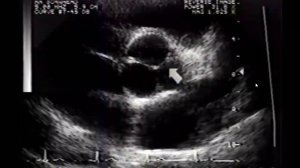 Видеолекция клиники Мэйо  В и М режим 1 я лекция