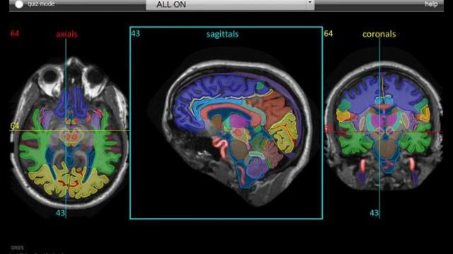 MRI tech first year Pt 3 смотреть онлайн
