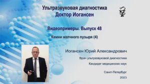 Ультразвуковая диагностика. Доктор Иогансен. Видеопримеры. Выпуск 48. Камни желчного пузыря (4).