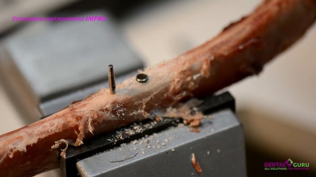 Установка имплантата IMPRO на кости смотреть онлайн