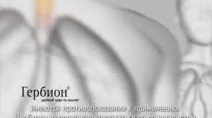 Рекламный ролик "Гербион"