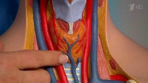 Гипертиреоз. Повышенная функция щитовидной железы. Жить здорово! Фрагмент выпуска от 23.09.2015