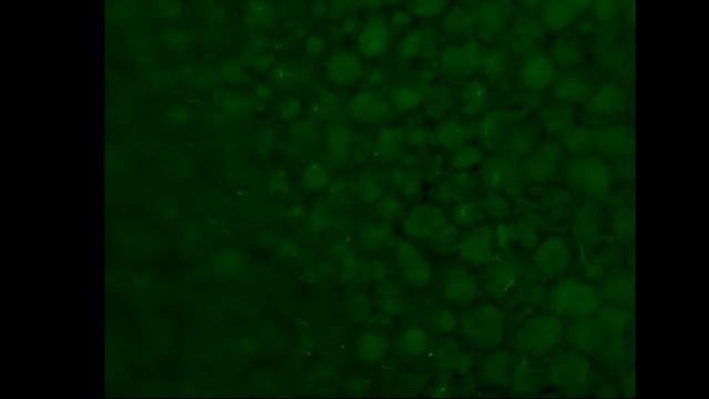 Лист и лепесток каланхоэ под микроскопом. Песок под микроскопом. смотреть онлайн