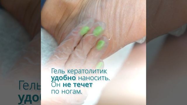 Удаление огрубевшей кожи на ногах за 5 минут. Средство для пяток, кератолитик. смотреть онлайн
