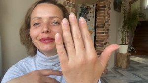 КАК ЖИВУТ ЛЮДИ БЕЗ ЩИТОВИДНОЙ ЖЕЛЕЗЫ почти 3 года после тиреоидэктомии