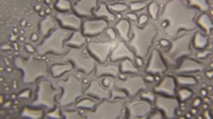 Капельки воды под микроскопом