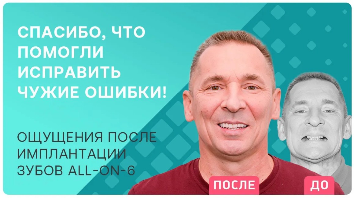 Почему имплантологи допускают ошибки? Пациент рассказывает о переустановке имплантов