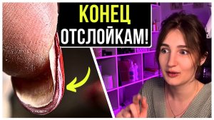 НАКОНЕЦ-ТО НАШЛА ПРИЧИНУ ОТСЛОЕК! ПОЛНОСТЬЮ отслоились ВСЕ НОГТИ!