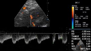 Вертебро базилярный сосудистый бассейн