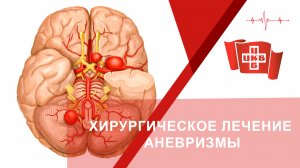 Хирургическое лечение аневризмы