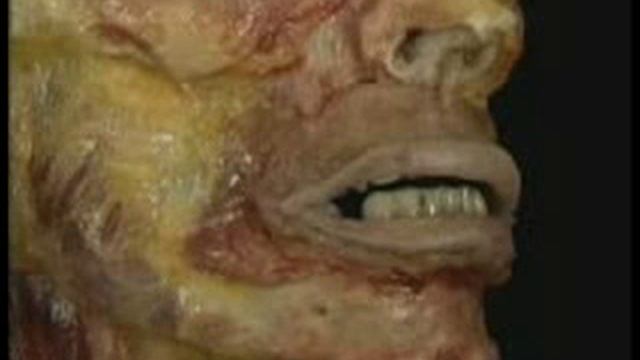 Мимические мышцы