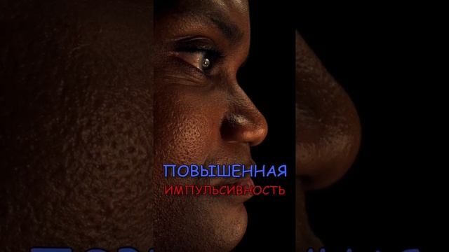 О чем говорят выпуклые глаза??? #shorts смотреть онлайн