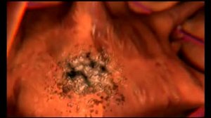 Алкоголь и печень