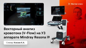 Векторный анализ кровотока (V-Flow) на УЗ аппарате Mindray Resona i9