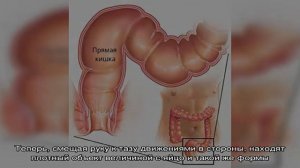 Техника ректального исследования крупного рогатого скота