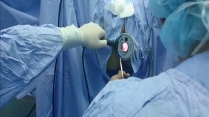 Ултразвуково лигиране на хемороидални артерии чрез HAL-RAR метода