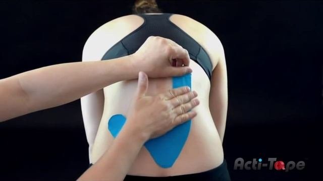 Кинезиотейпирование спины