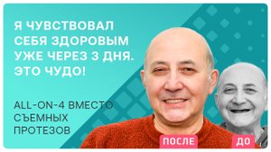 Имплантация без синус-лифтинга. Что делать, если съемные протезы надоели?
