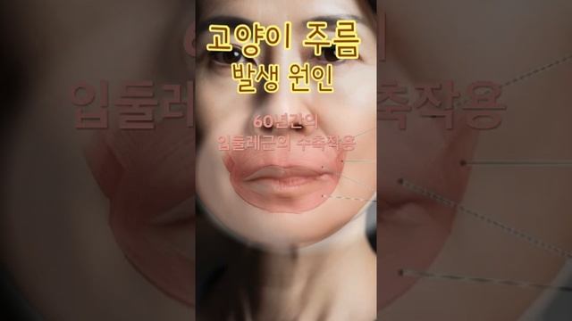 입술 고양이 주름은 입술 오무리는 근육으로 인해 발생