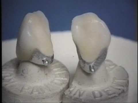 металлокерамика 3 часть для зубных техников смотреть онлайн