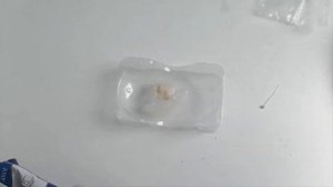 EELOHE METAL REPAIR PREVIEW