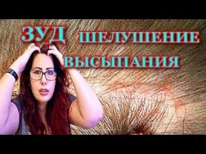 Выпадение волос_ Зуд_ Шелушение_Высыпания на коже головы_ Что делать!