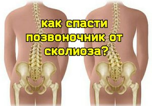 Поясничный сколиоз вредит сердцу и мозгу, разрушает печень и кишечник. Какие нужны упражнения?