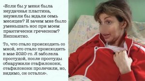 Алиса Казьмина откровенно рассказала что же случилось с ее лицом