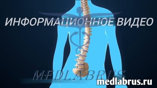 Сколиоз. Хирургия сколиоза