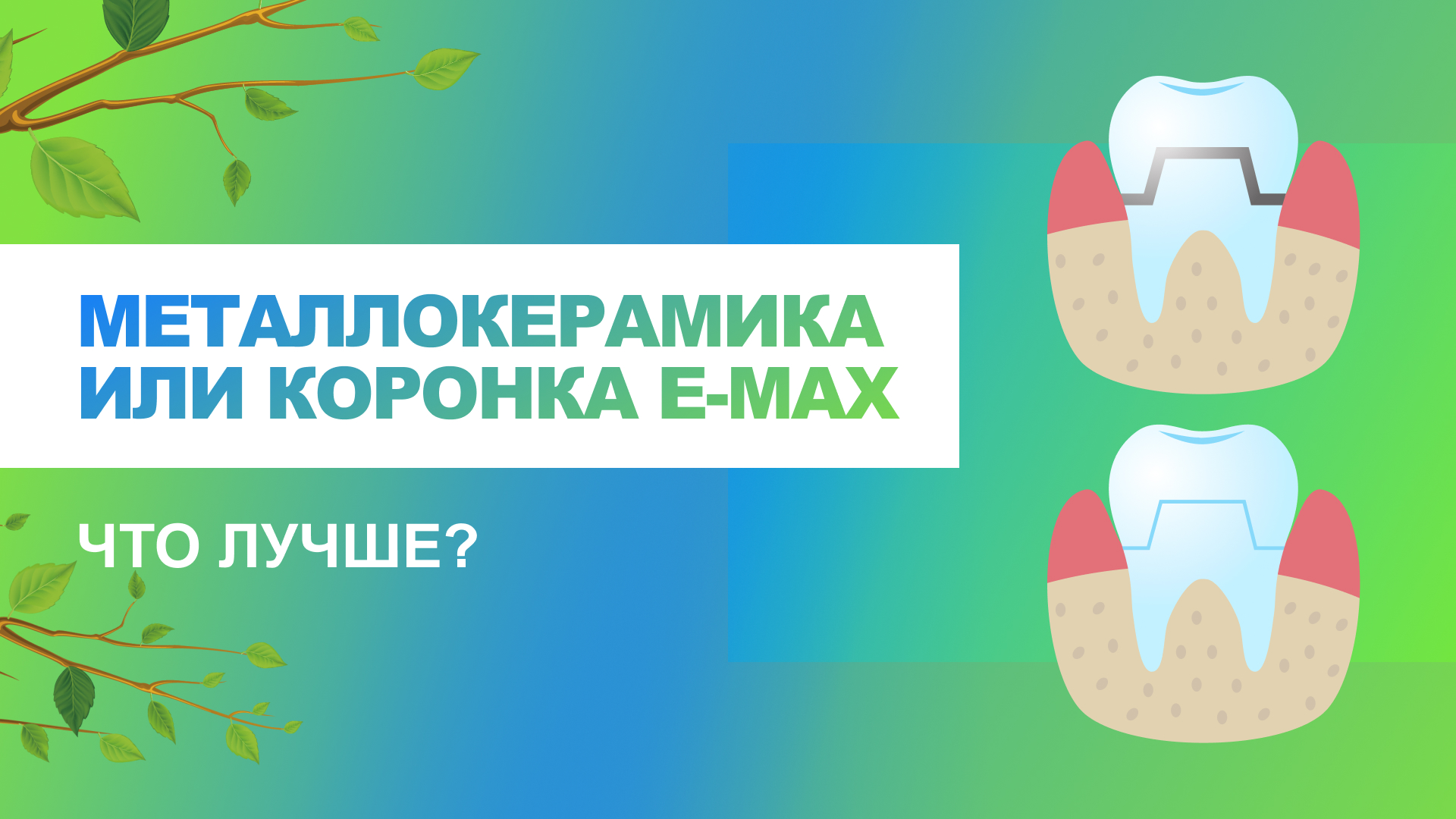 ? Металлокерамика или коронка e-max, какие материалы лучше?