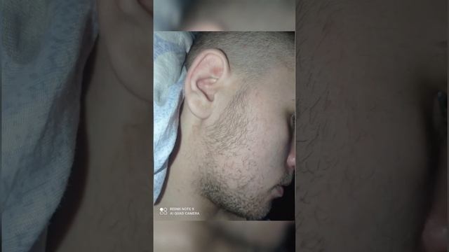 Миноксидил / Рост бороды смотреть онлайн