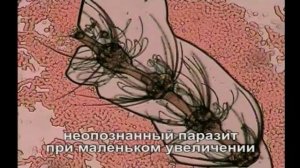 Алексей Водовозов – «13 признаков развода на диагноз»