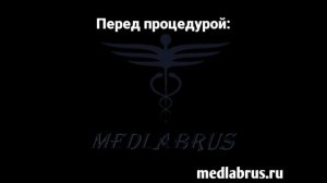 Родоразрешение  с помощью кесарева сечения