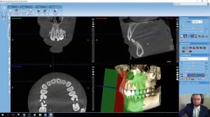 Практическое применение программы Planmeca Romexis Viewer (снимок КЛКТ обеих челюстей)