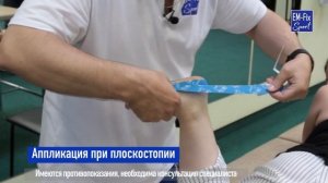 Тейпирование при плоскостопии