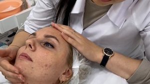 САЛИЦИЛОВЫЙ ПИЛИНГ презентация