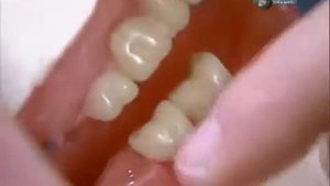 Искусственные зубы «Как это работает» №86