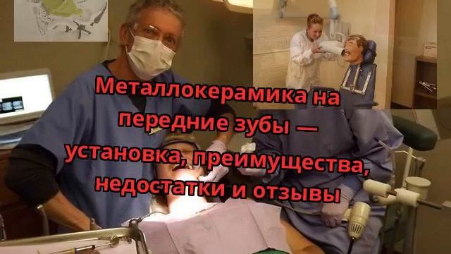 Металлокерамика на передние зубы — установка, преимущества, недостатки и отзывы смотреть онлайн